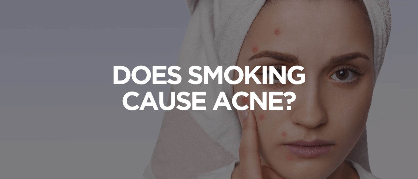 Does Smoking Cause Acne