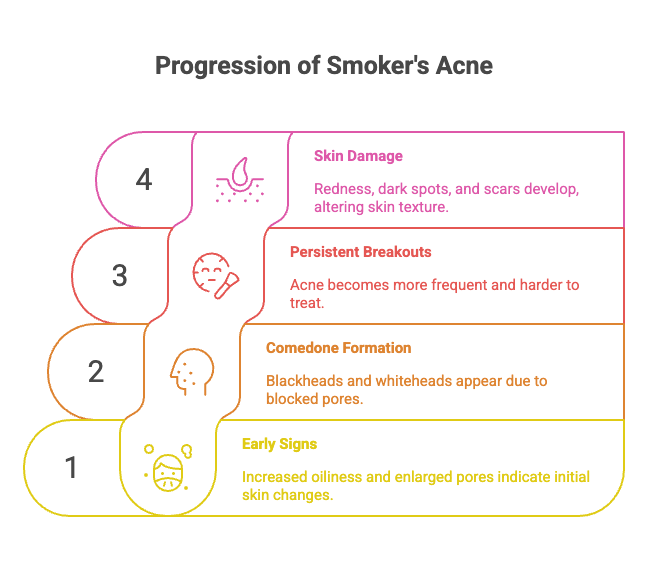 Does Smoking Cause Acne? 6 Progression of Smoker's Acne